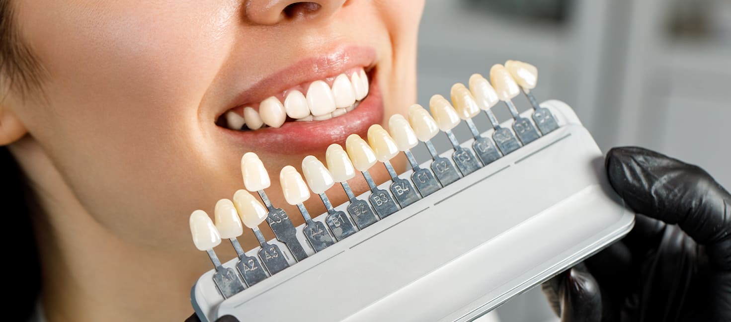 Diş kaplaması Bilim Diş Kliniğinde uygulanır.