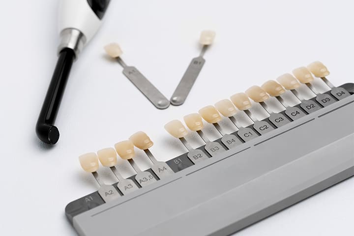 Maltepe'de Porselen Diş Kaplama Maliyeti