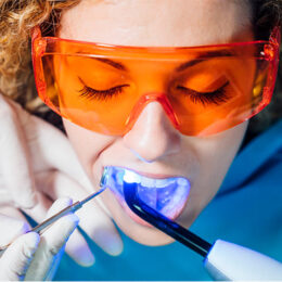 Diş Beyazlatma Yöntemi - Maltepe Bilim Diş Kliniği