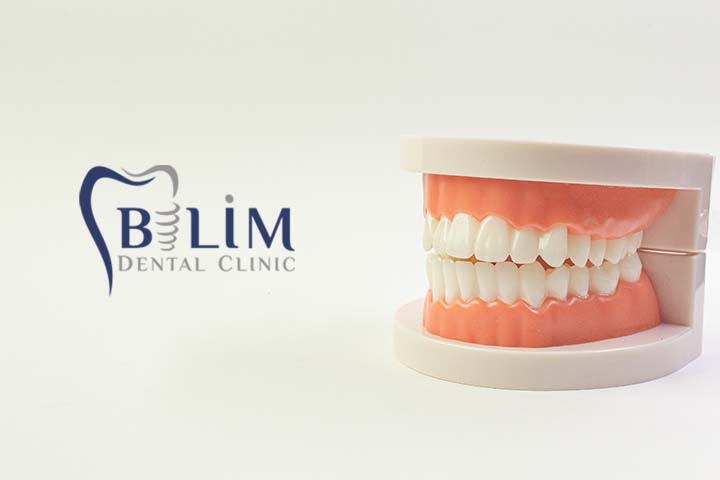 maltepe bilim diş kliniği diş protezi, protez diş, takma diş