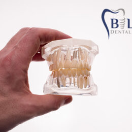 Geçici dişler, diş kaybı yaşayan bireyler için kalıcı protezler yapılana kadar kullanılan, estetik ve fonksiyonelliği geçici olarak sağlayan yapay dişlerdir.