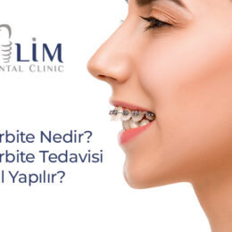 Ortodontik bir sorun olarak değerlendirilen overbite, estetik kaygılara neden olabilir. Hem çene eklemi ve diş sağlığı üzerinde olumsuz etki yapabilir.