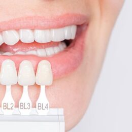 Emax Diş Kaplama Uzun Ömürlü Müdür? - Maltepe Bilim Diş Kliniği