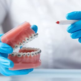 Ortodontik Tedavi Sırasında Nelere Dikkat Edilmelidir? - Maltepe Bilim Diş Kliniği