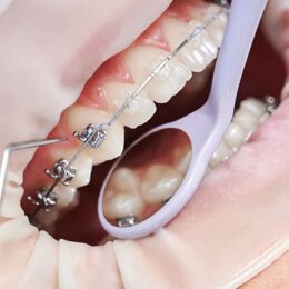 Diş Teli Temizliği Nasıl Yapılır - Maltepe Bilim Diş Kliniği