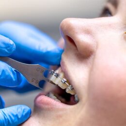 Maltepe'de Ortodonti Tedavisi Fiyatları - Maltepe Bilim Diş Kliniği