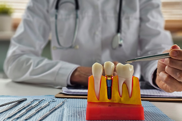 Kemik Yetersizliğinde Diş İmplantı - Maltepe Bilim Diş Kliniği