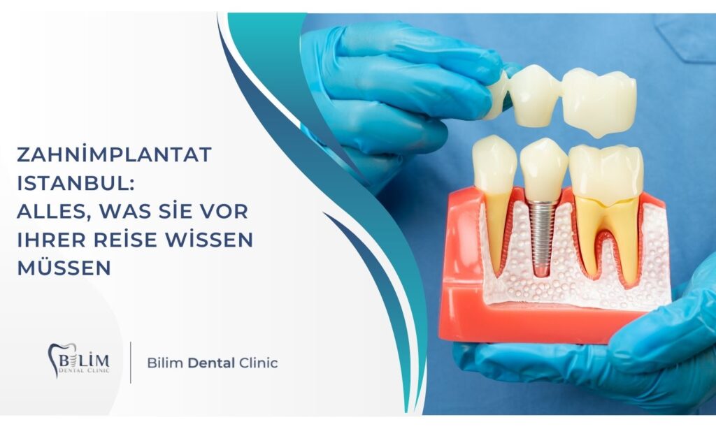 Zahnimplantat Istanbul: Alles, was Sie vor Ihrer Reise wissen müssen