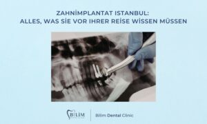 Zahnimplantat Istanbul: Alles, was Sie vor Ihrer Reise wissen müssen