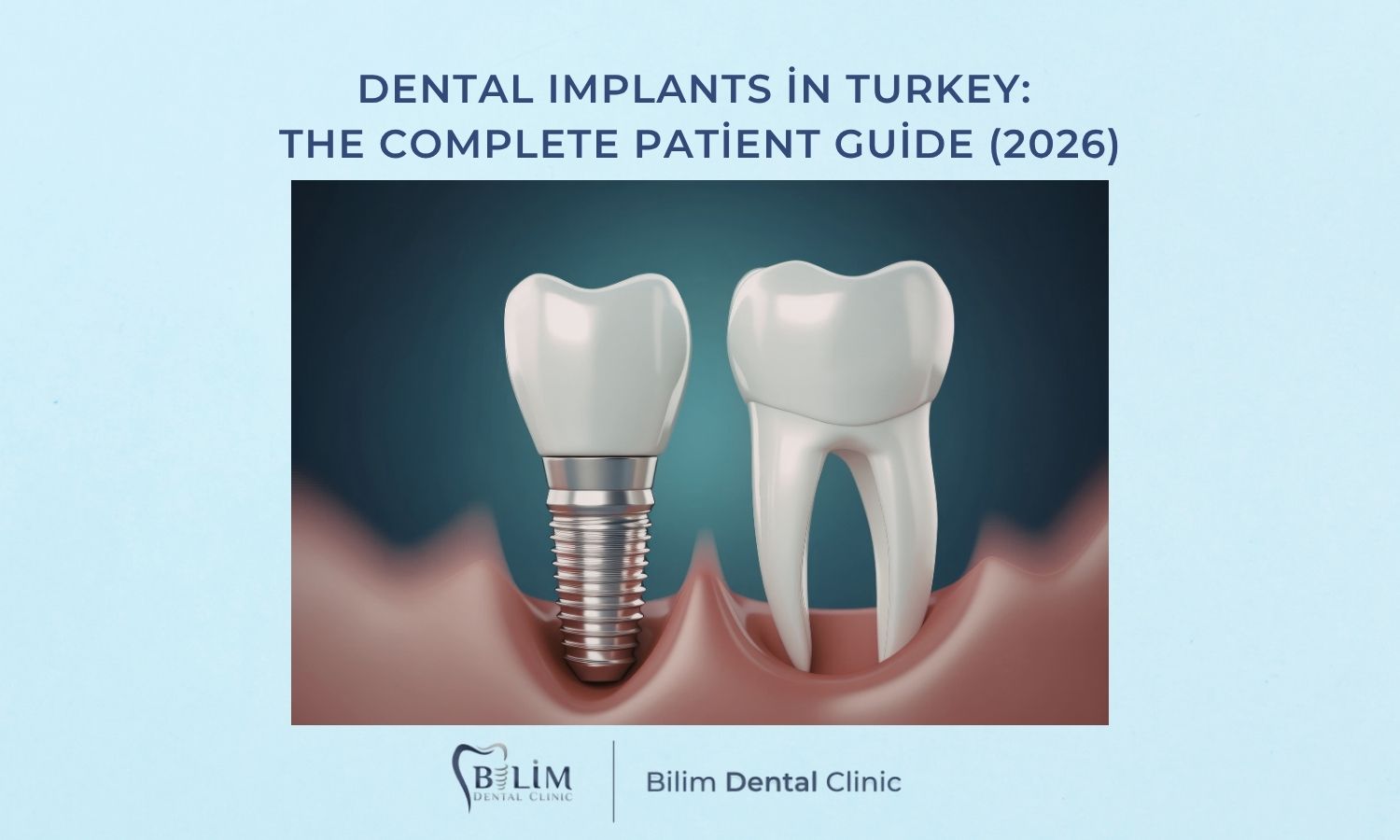 Dental Implants in Turkey: Everything You Need to Know (2026)
