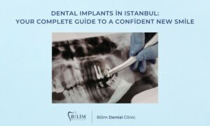 Dental Implants in Istanbul: Your Complete Guide to a Confident New Smile