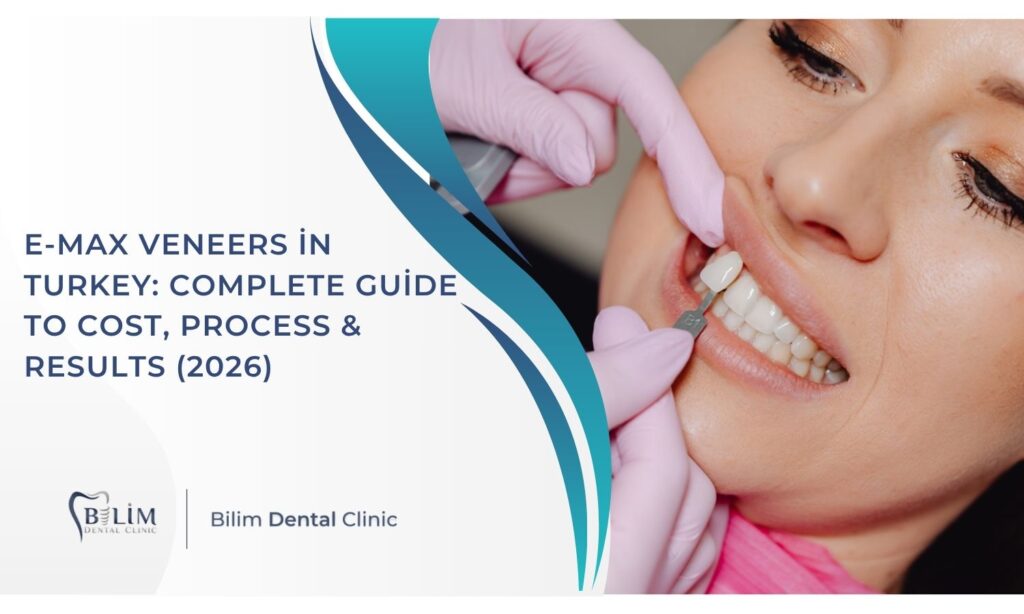 E-Max Veneers in Turkey: Complete Guide to Cost, Process & Results (2026)