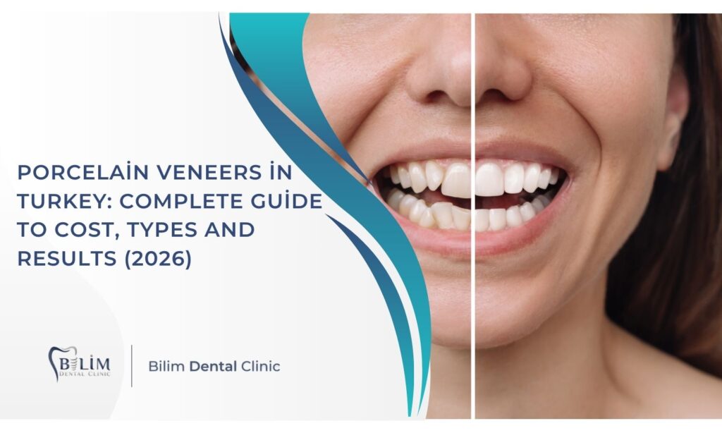 Porcelain Veneers in Turkey: Complete Guide to Cost, Types and Results (2026)