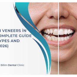 Porcelain Veneers in Turkey: Complete Guide to Cost, Types and Results (2026)