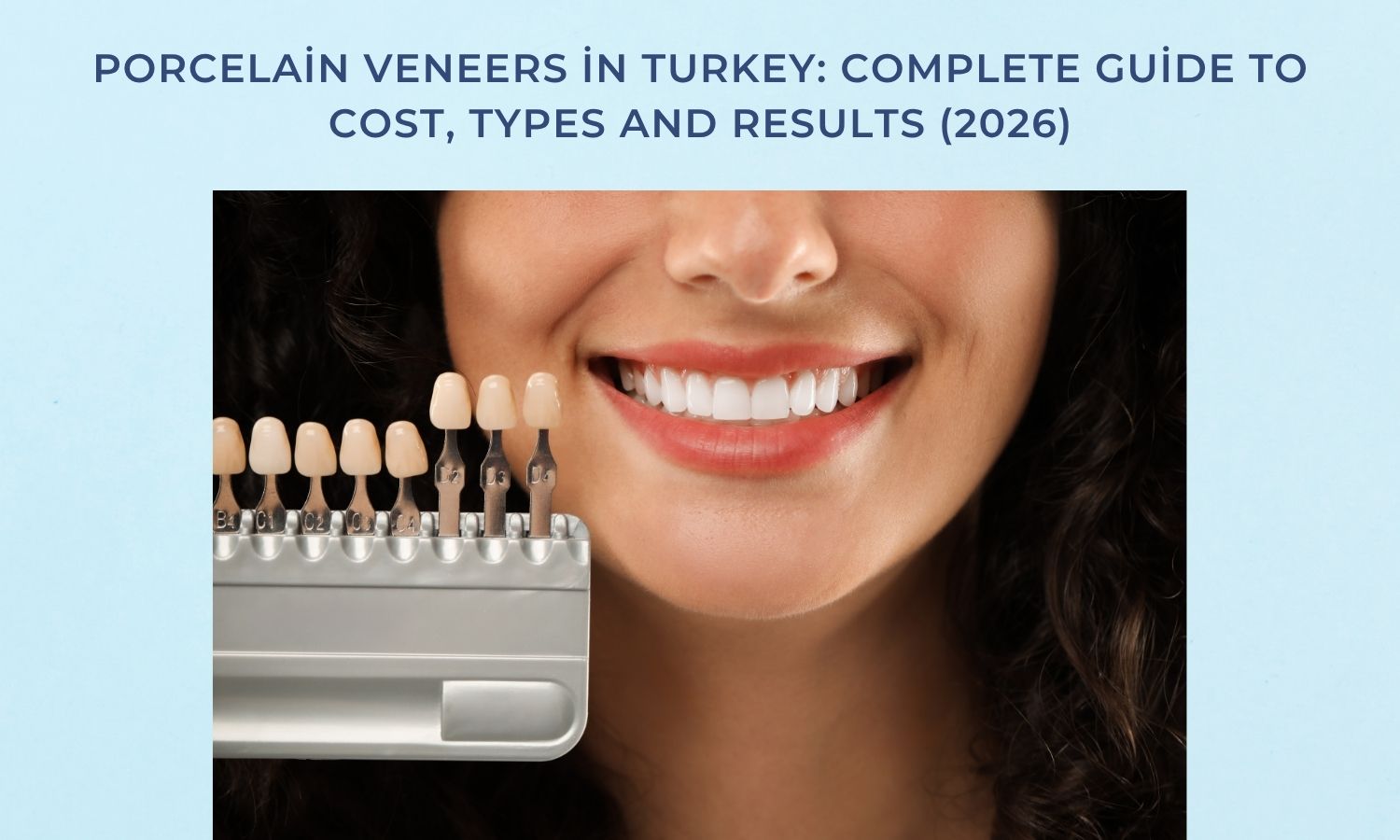 Porcelain Veneers in Turkey: Complete Guide to Cost, Types and Results (2026)