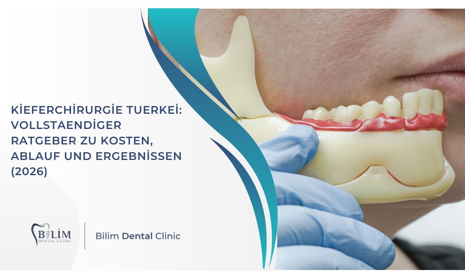 Kieferchirurgie Tuerkei: Kosten, Ablauf und vollstaendiger Ratgeber (2026)
