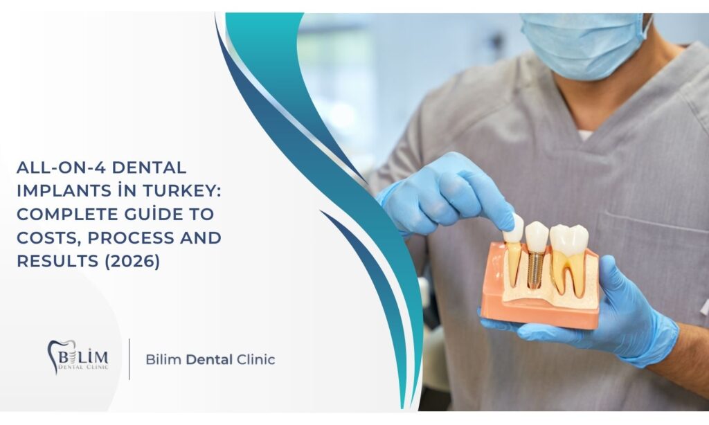 All-on-4 Dental Implants in Turkey: Complete Guide to Costs, Process and Results (2026)
