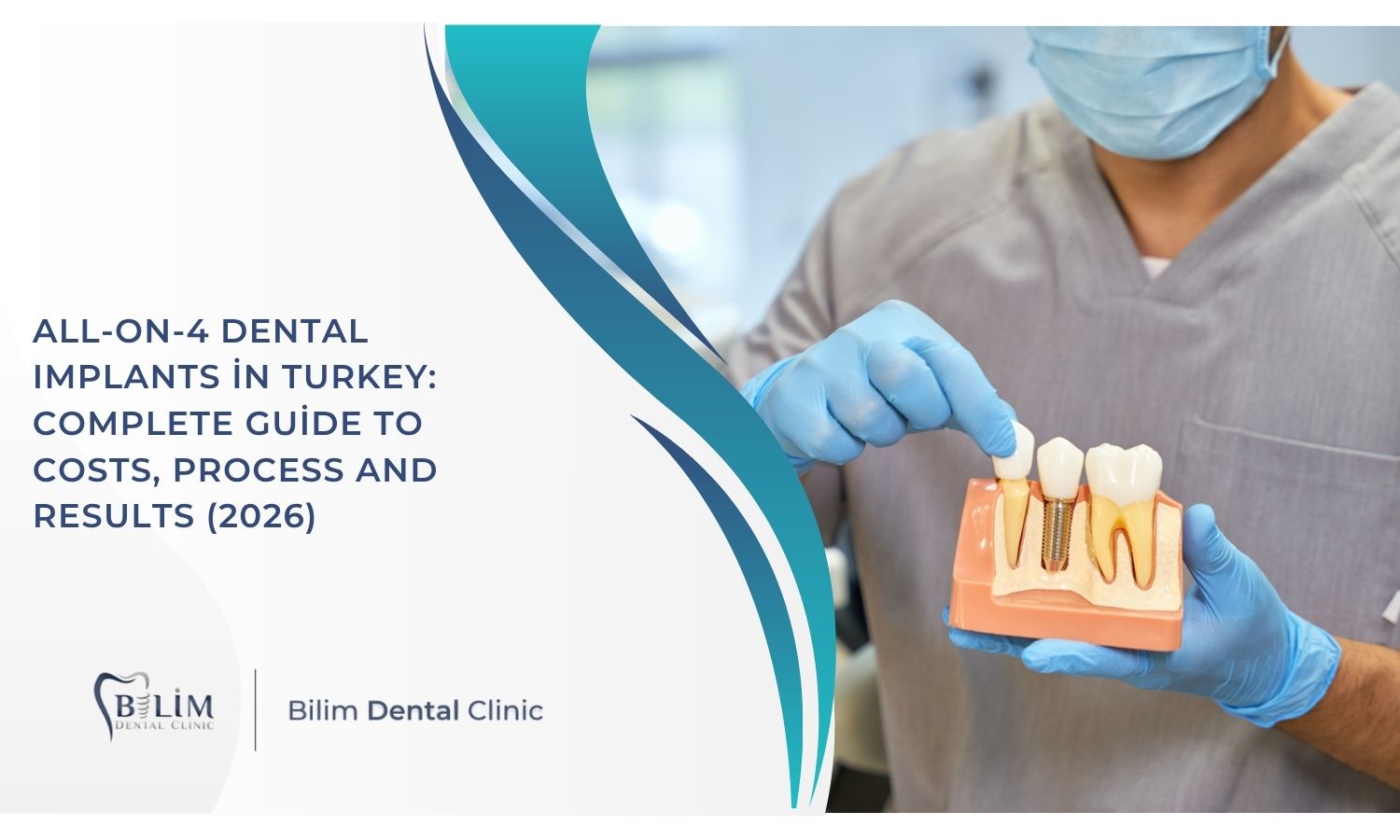 All-on-4 Dental Implants in Turkey: Complete Guide to Costs, Process and Results (2026)
