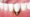 Peri-implantitis