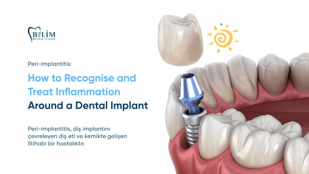 peri-implantitis