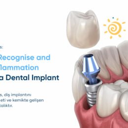 peri-implantitis