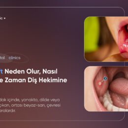 ağızda aft