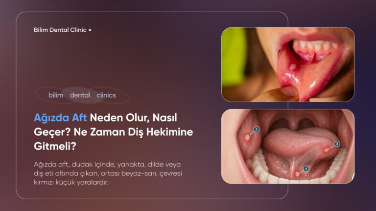 ağızda aft