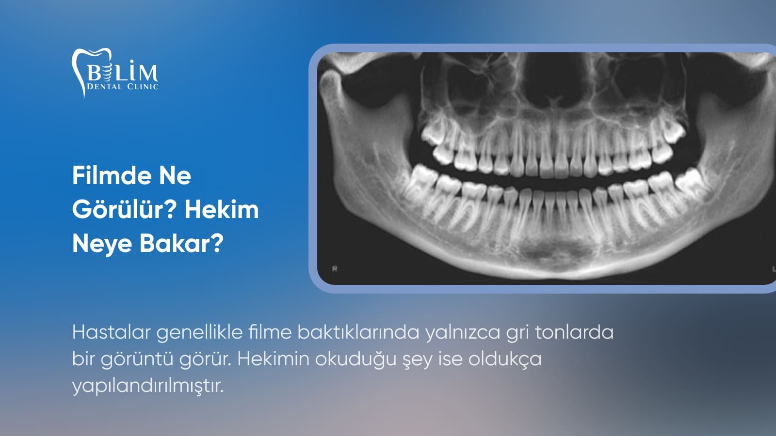 diş röntgeni