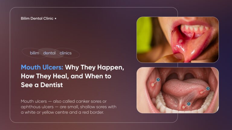 mouth ulcers