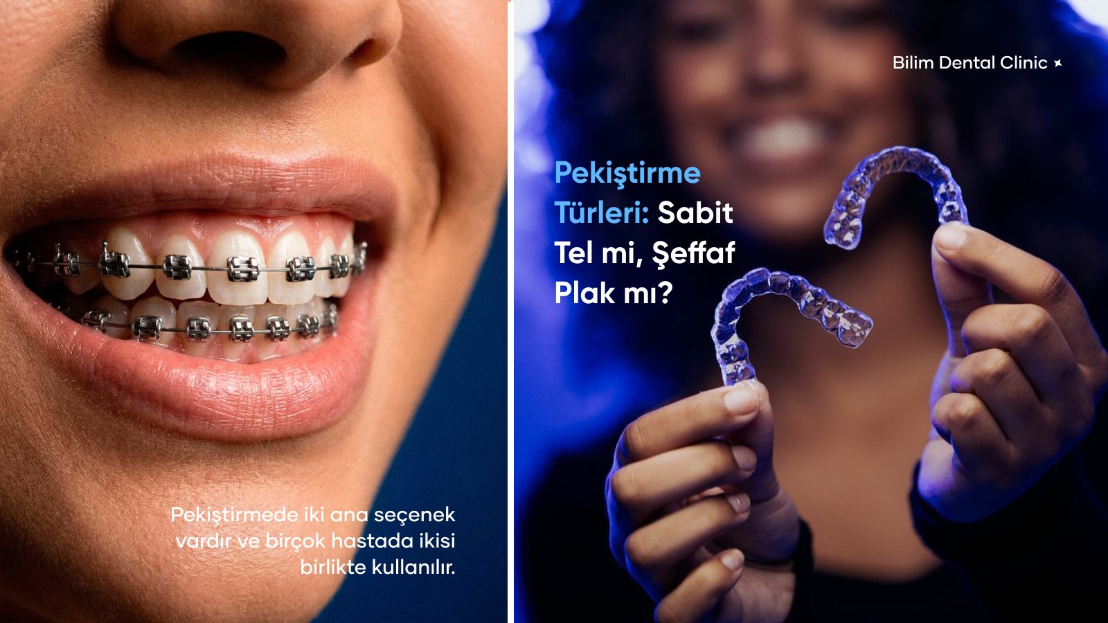 pekiştirme plağı