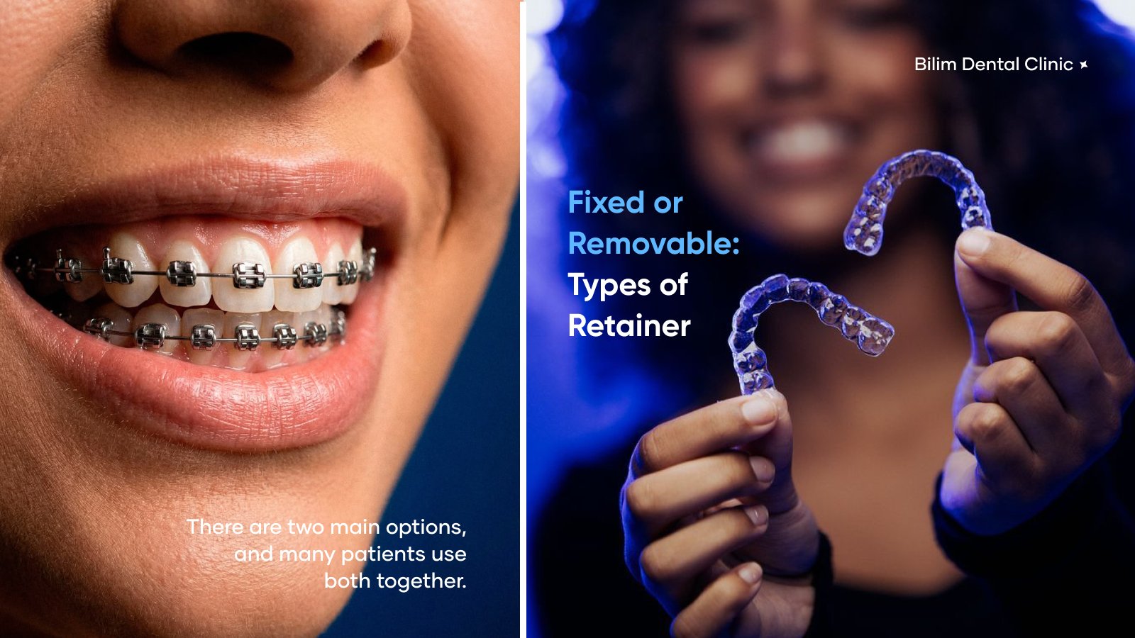 retainer