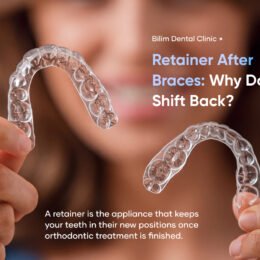 retainer