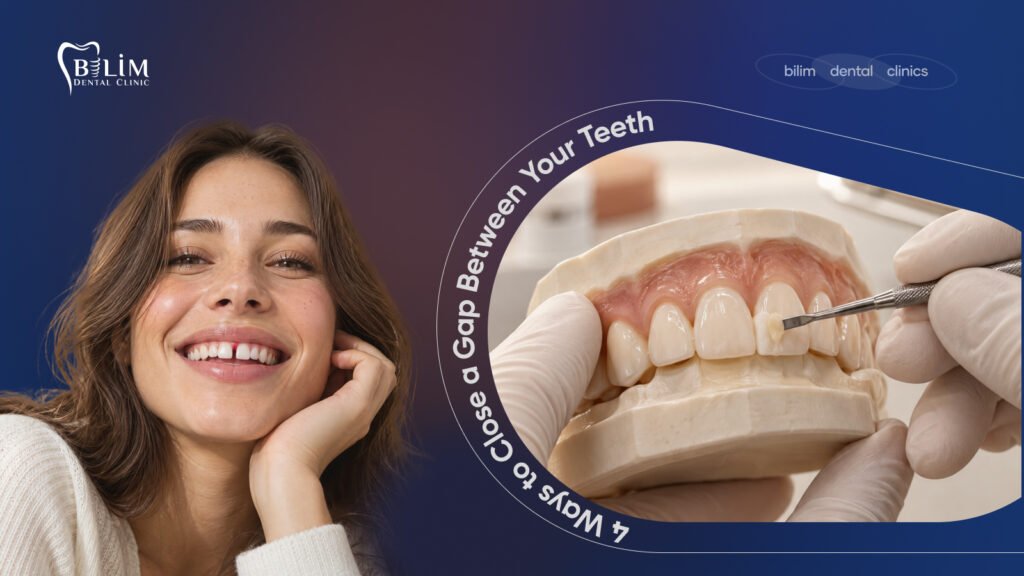 diastema