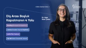 diş arası boşluk