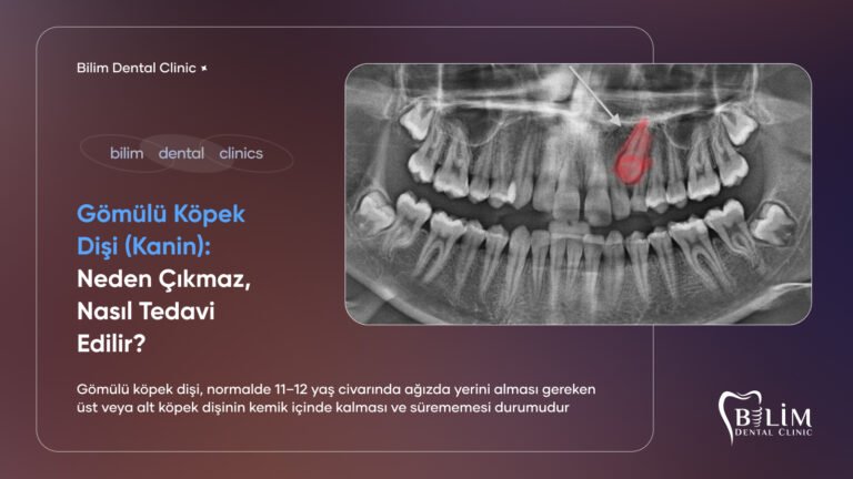 gömülü köpek dişi