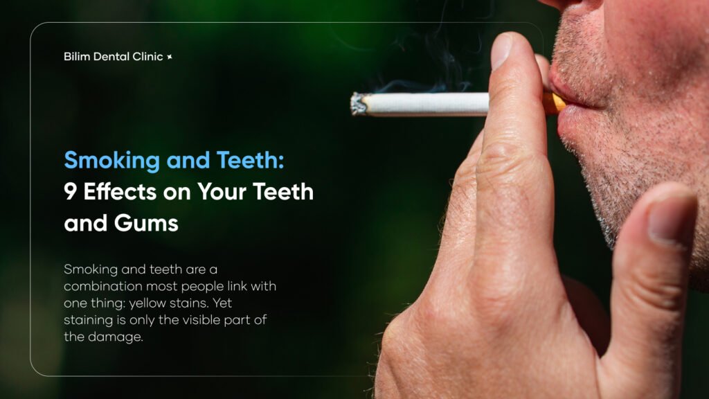smoking and teeth